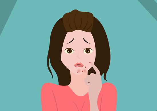 擠痘痘顱內(nèi)感染能治愈嗎?擠了三角區(qū)域的痘痘怎么避免感染