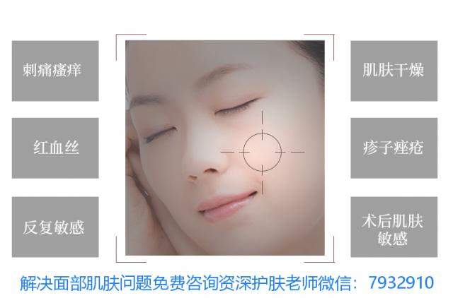 什么是春敏?朵嘉濃保濕修復乳對春敏期的妹子管用嗎? 007.png