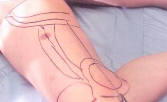 ȳ֬û֏(f)ȳ֬ĺzYЩ