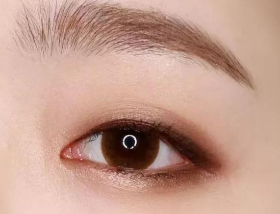 雙眼皮貼貼久了可能讓眼皮下垂?全切雙眼皮能管一輩子嗎