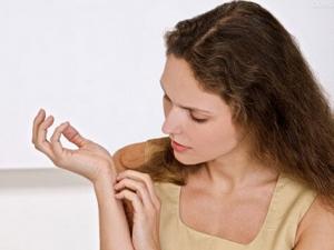 蚊蟲叮咬紅腫怎么辦？蚊蟲叮咬紅腫怎么止癢？