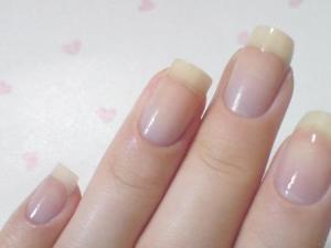 健康的指甲顏色:從指甲顏色看健康