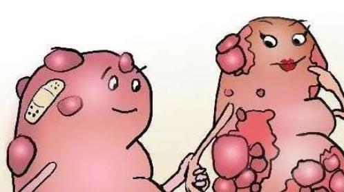 得了腎結石怎么辦?腎結石需要注意什么?患腎結石的原因