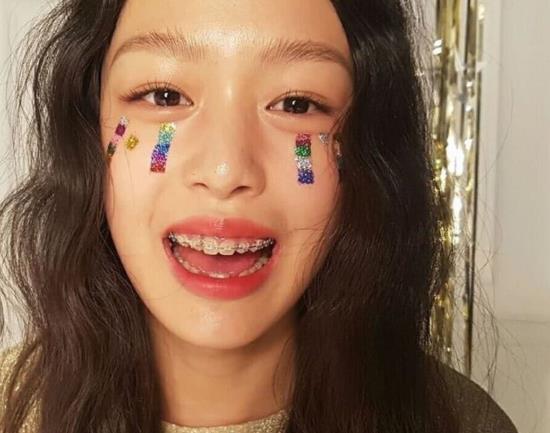 戴牙套一般多久起效果?戴牙套第四天可以吃米飯嗎