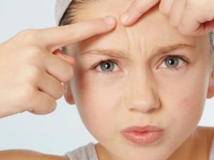 臉上長痘痘怎么調理？臉上長痘痘切忌不能做五件事