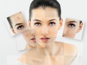 美白祛斑誤區：愛美女性必知的祛斑四誤區