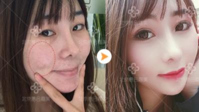 惠合嘉美整形好嗎 專業(yè)服務 塑造你的專屬美