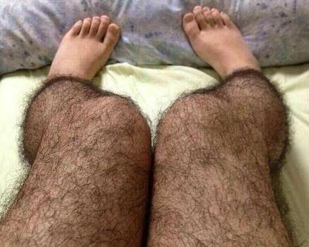 女人毛發太旺盛是什么原因該怎么脫毛 體毛越剃越濃嗎