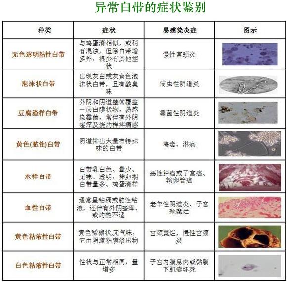 正常白帶是什么樣子的真實圖片 白帶異常各種癥狀圖片大全