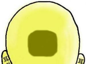 骨相圖解:四方金印骨