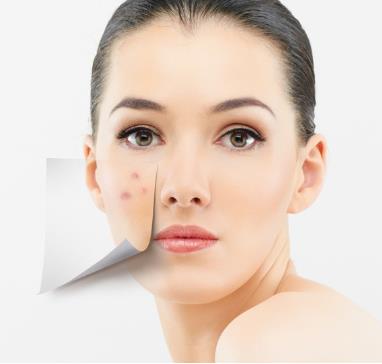 臉上長痘痘是什么原因？臉上長痘痘怎么調理？青春痘怎么消除
