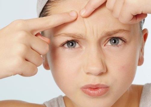 臉上長痘痘怎么調理?臉上長痘痘切忌五件事千萬不能做