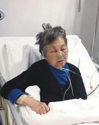 教授醉酒耍酒瘋殘忍毆打7旬老人令人發(fā)指,被打老人昏迷大小便失禁