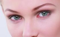 結(jié)膜炎會(huì)傳染嗎？ 科學(xué)的認(rèn)識(shí)結(jié)膜炎