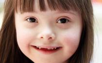 你了解唐氏癥嗎？ 唐氏癥有哪些癥狀？