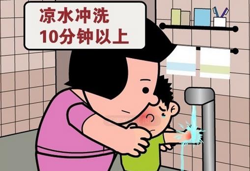 被開水燙傷怎么辦？應急措施介紹