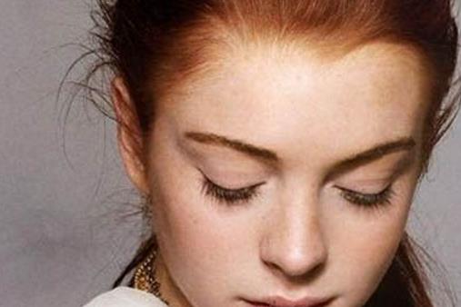 祛斑失敗的原因有哪些 如何應(yīng)對