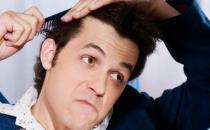 中年男性脫發怎么辦？