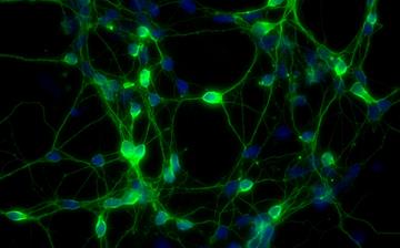 【雌激素】雌激素高怎么辦_雌激素低的原因_雌激素高的原因_雌激素高的食物有哪些 【雌激素】雌激素高怎么辦_雌激素低的原因_雌激素高的原因_雌激素高的食物有哪些