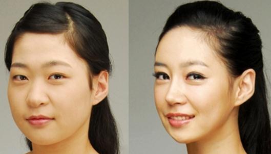 咬肌瘦臉針有什么危害？