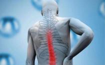 教你如何有效預防腰肌勞損