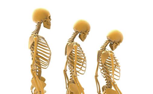 哪些方法可以預防骨質疏松