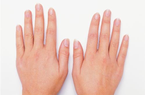 從指甲上竟然看出這么多病癥