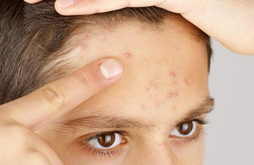 哪些癥狀需要排毒?怎么排解體內毒素