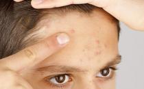 毒氣長期淤積體內需要排毒 從飲食教你排解體內毒素