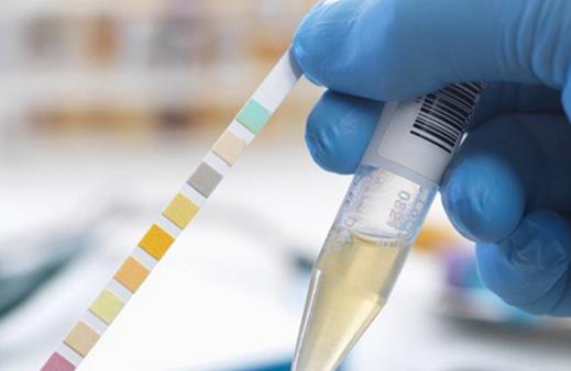 尿液渾濁的原因 教你判斷尿液是否渾濁 