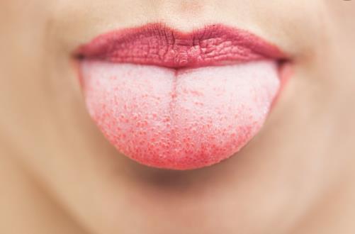 健康保健 從舌苔中便能看出健康