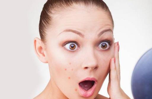 這六大因素容易導(dǎo)致臉頰長(zhǎng)痘