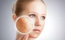 冬季=皮膚干燥瘙癢保養方法 皮膚干燥常吃3種蔬菜