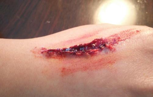 什么是破傷風？為什么破傷風會致命？