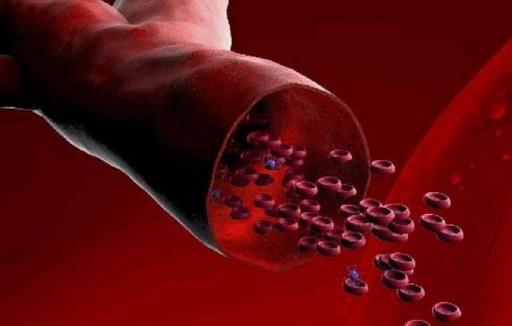 血液粘稠后身體會出現哪些信號？