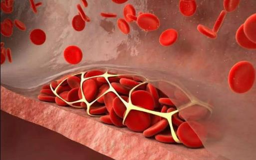 血液粘稠后身體會出現哪些信號？