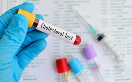 血脂總是上下波動？醫生：要注意這幾點，避免心腦血管出