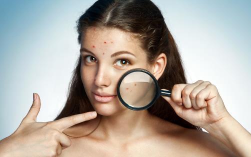 敏感肌如何護膚 溫柔呵護是關鍵