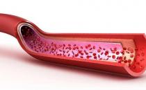 血管是人的生命的通道 養護血管的飲食調理