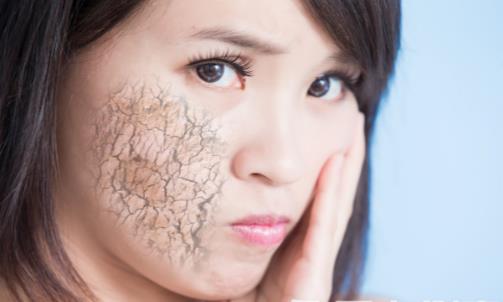 皮膚干燥脫皮怎么辦 4招幫你搞定它