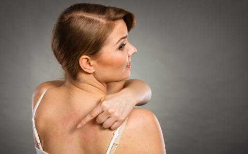 后背成長痘重災區 背后長痘的解決措施及預防方法