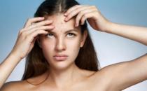 臉上反復長痘痘的原因 祛痘嚴控紫外線傷害加強防曬