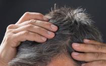 ?導致頭發變白的壞習慣 小習慣就能擁有一頭烏黑秀發