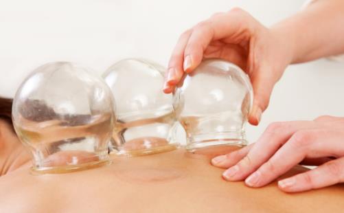 拔火罐能減肥?顏色深代表毒素多、濕氣重?