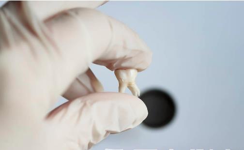 智齒發炎的5種療法 拔智齒的影響和風險