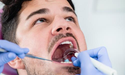 為了美白反而傷害牙齒？洗牙不是你想得那樣！