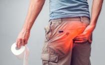 久坐人群避免痔瘡危害 治療痔瘡有效的9個偏方