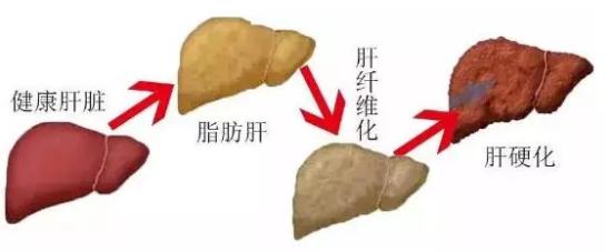 貴州治丙肝醫院靠不靠譜 貴州中醫肝病醫院質量醫療的踐行者