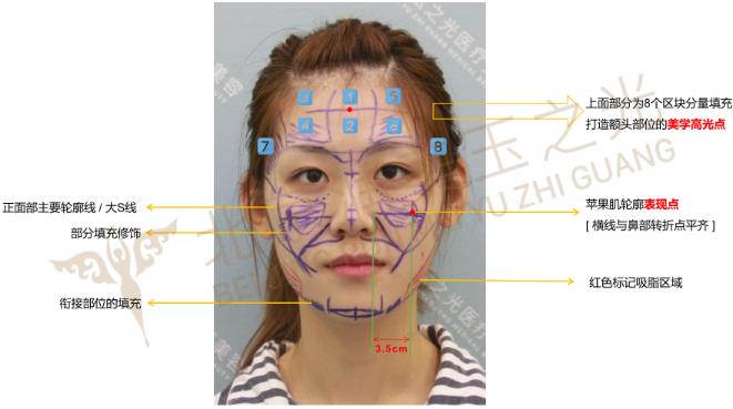 自體多肽脂肪實現新突破，塑造無法復制的自然美