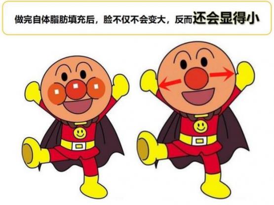 韋元強講解:瘦子也適合做自體脂肪填充嗎?